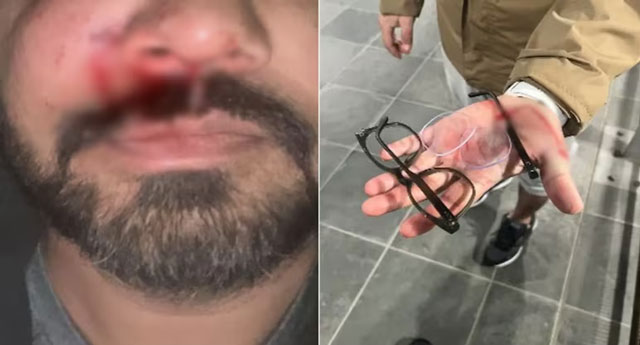 Indian-origin man brutally assaulted in suspected racist attack in Dublin